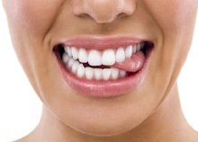 Lézeres fogfehérítés a több árnyalattal fehérebb fogakért a Mosolygyár Fogászattól