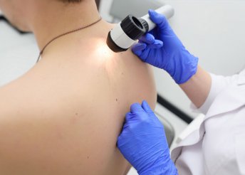 Dermatoszkópos anyajegy- és melanomaszűrés a Budai Magánorvosi Centrumban