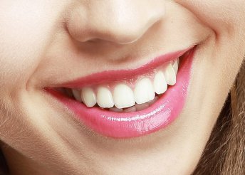 Ultrahangos fogkő-eltávolítás Airflow fehérítő hatású polírozással, állapotfelméréssel
