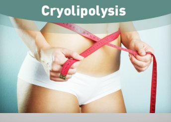 Cryo Lipolysis 3 alkalmas zsírcsökkentő bérlet a Mimo szalonba